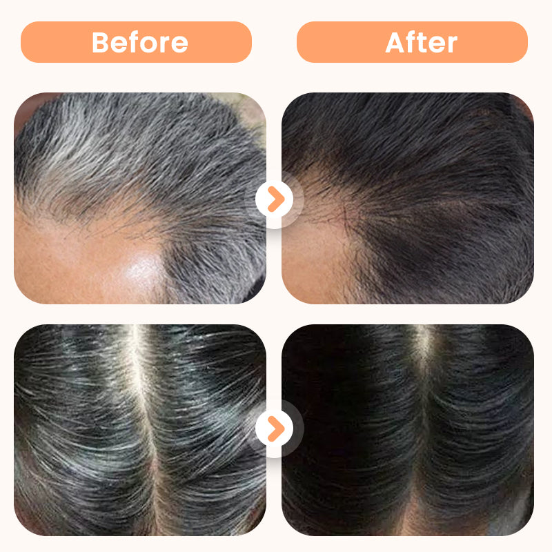 💆‍♀️Buy 2 Get 1 Free🌿Plant Extract Hair Dye for Gray Hair